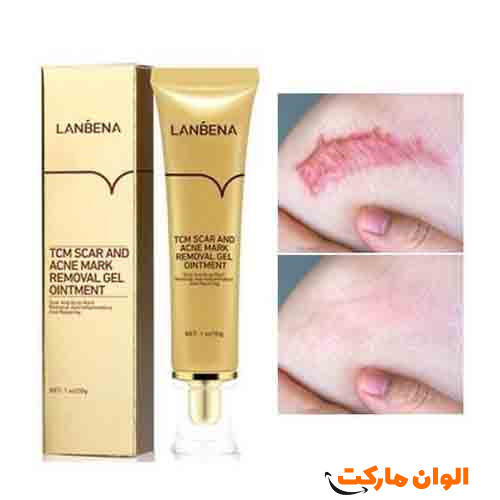 خرید-ژل-ترمیم-کننده-جای-جوش-و-اسکار-لانبنا-lanbena-کد-g-2833-تهران-